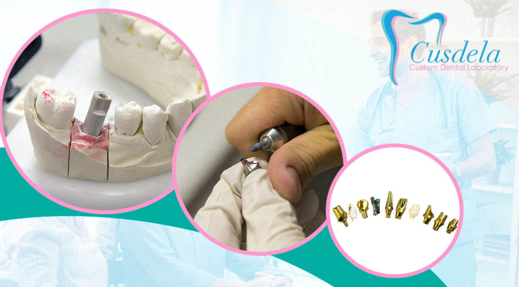 Custom vs Stock Abutments What’s the difference? Blog